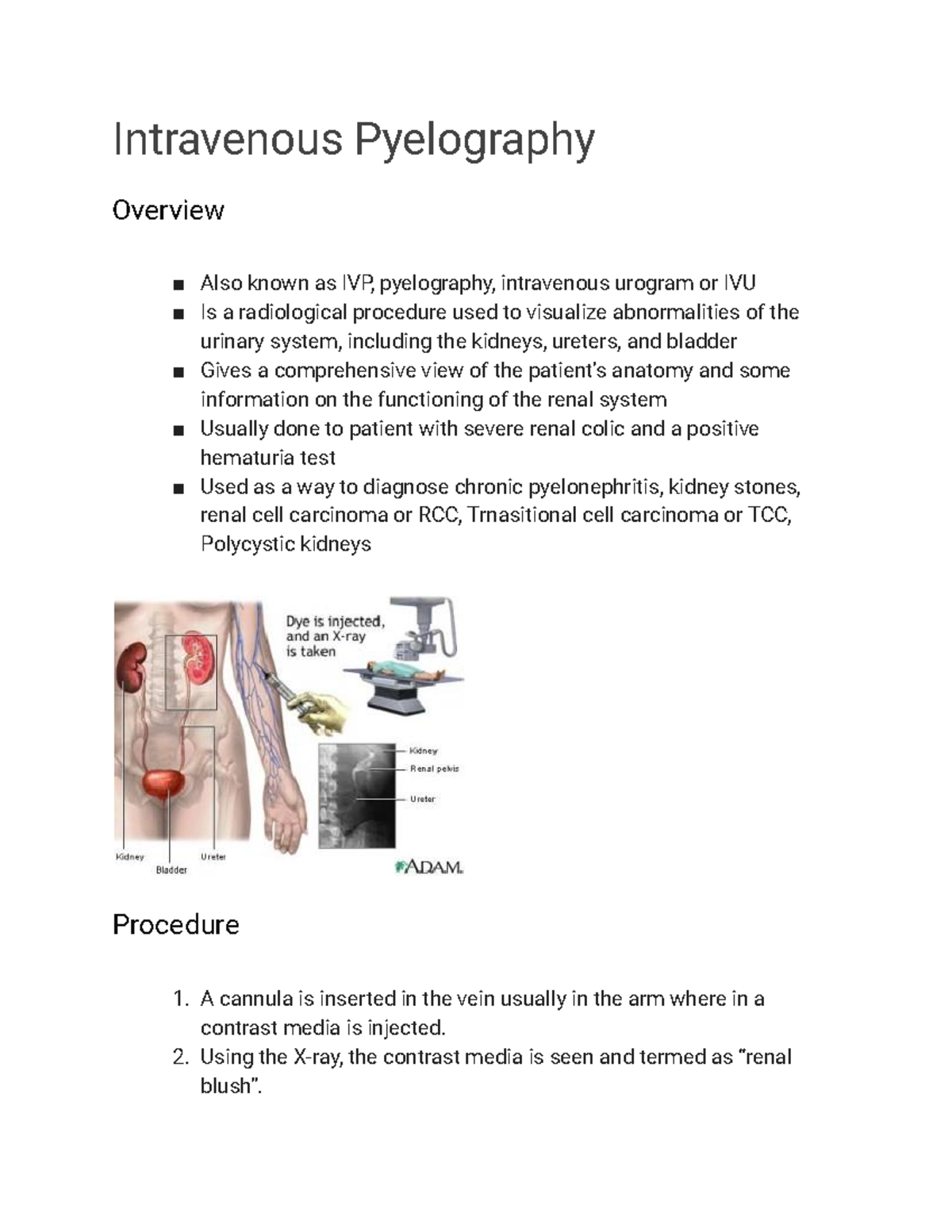 What Is An Intravenous Pyelogram Ivp