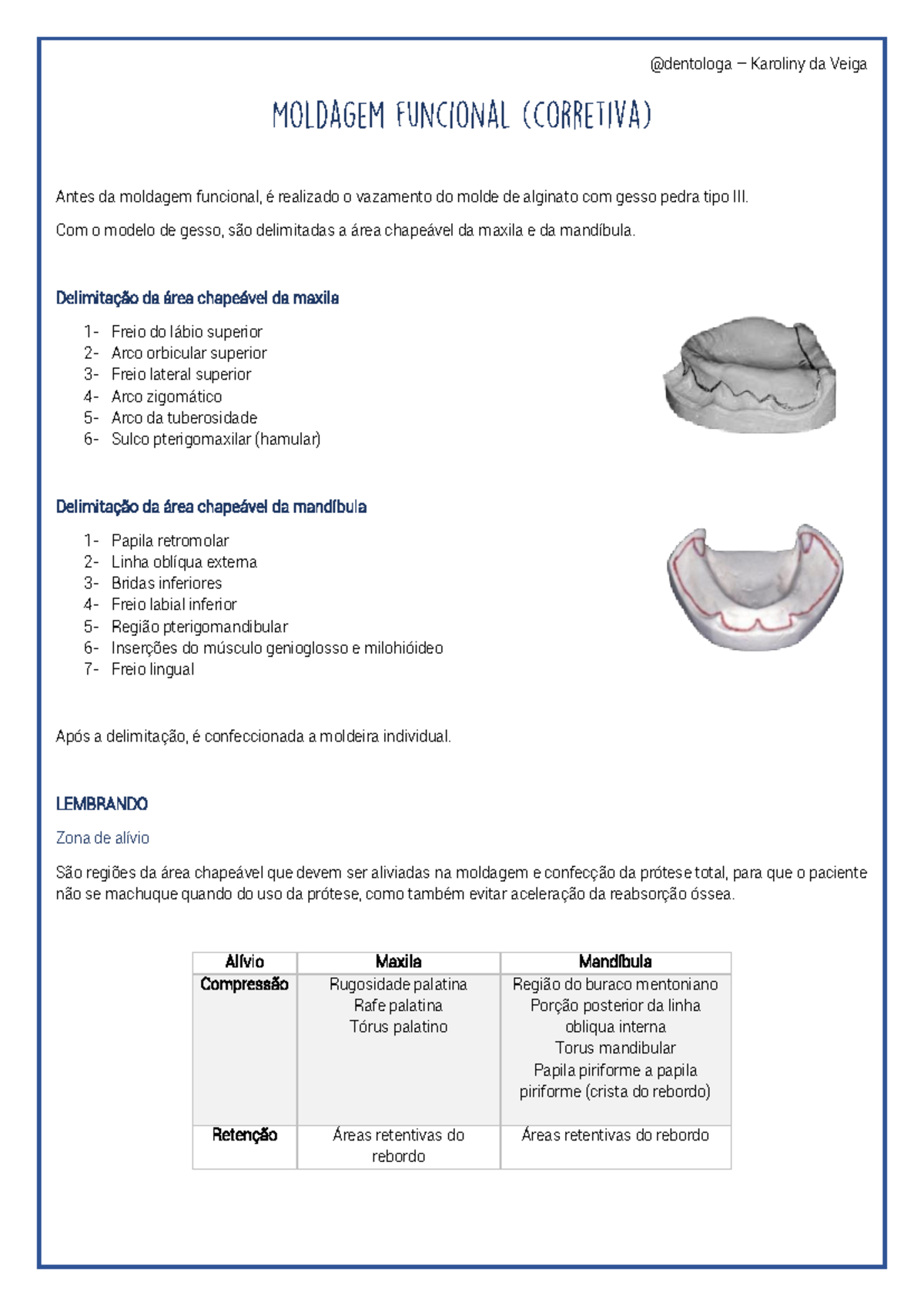 Moldagem Funcional Com O Modelo De Gesso S O Delimitadas A Rea