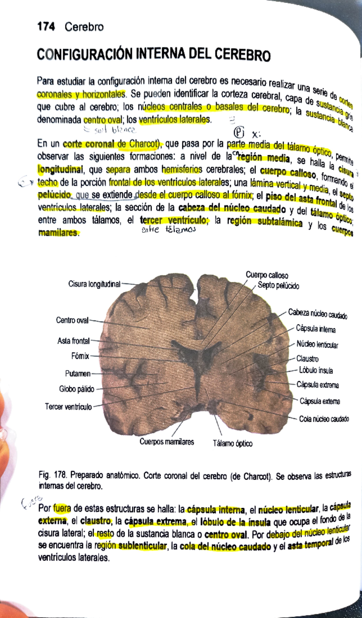 Adobe Scan Jul 05, 2024 - Neuroanatomía apuntes - 174 Cerebro ...