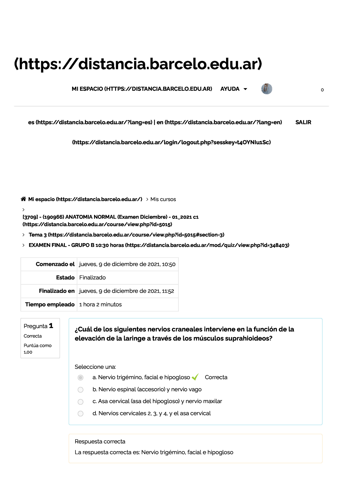 Examen Final 2021 BA - Grupo B 10 30 Horas - (distancia.barcelo.edu) MI ...