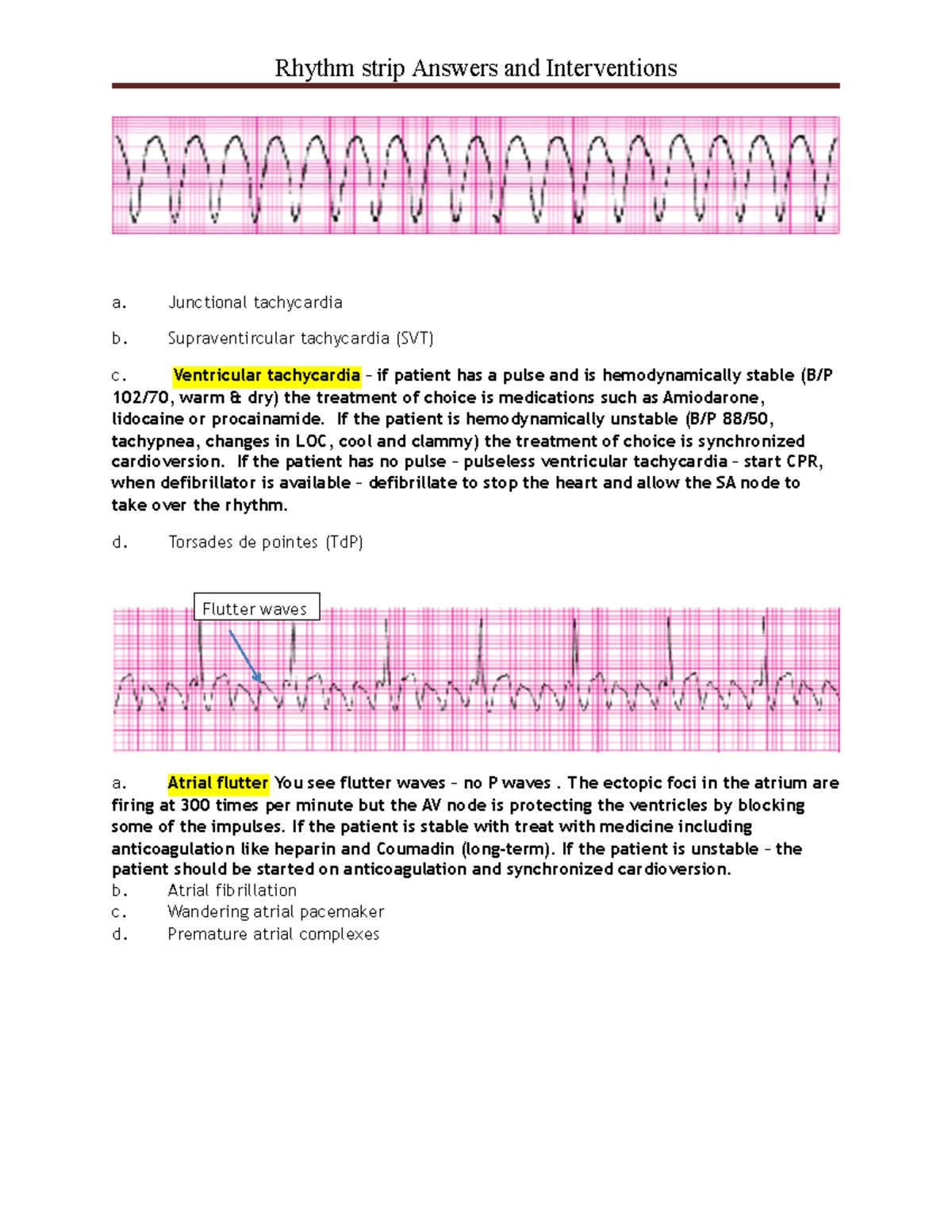 Rhythm 2 Answers - Dr Rickeard - Rhythm strip Answers and Interventions ...