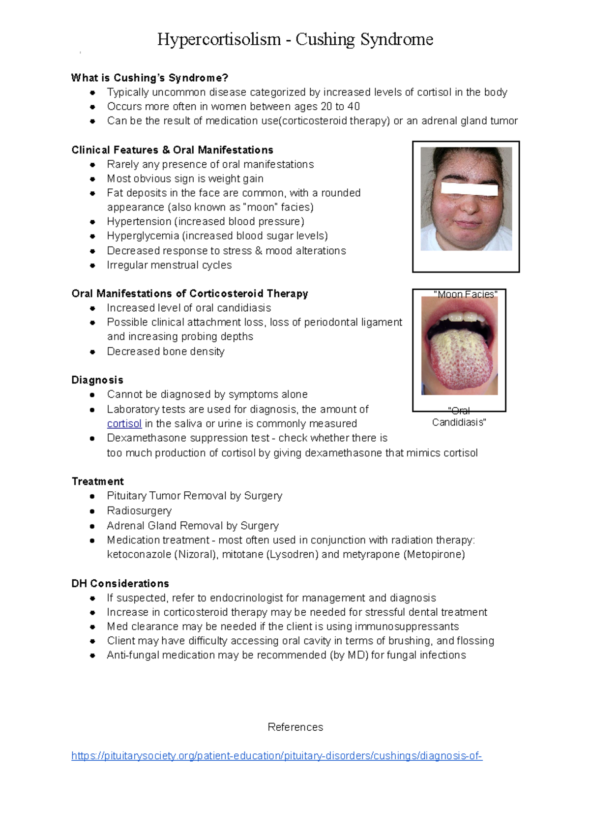 Hypercortisolism dental poster Hypercortisolism Cushing Syndrome