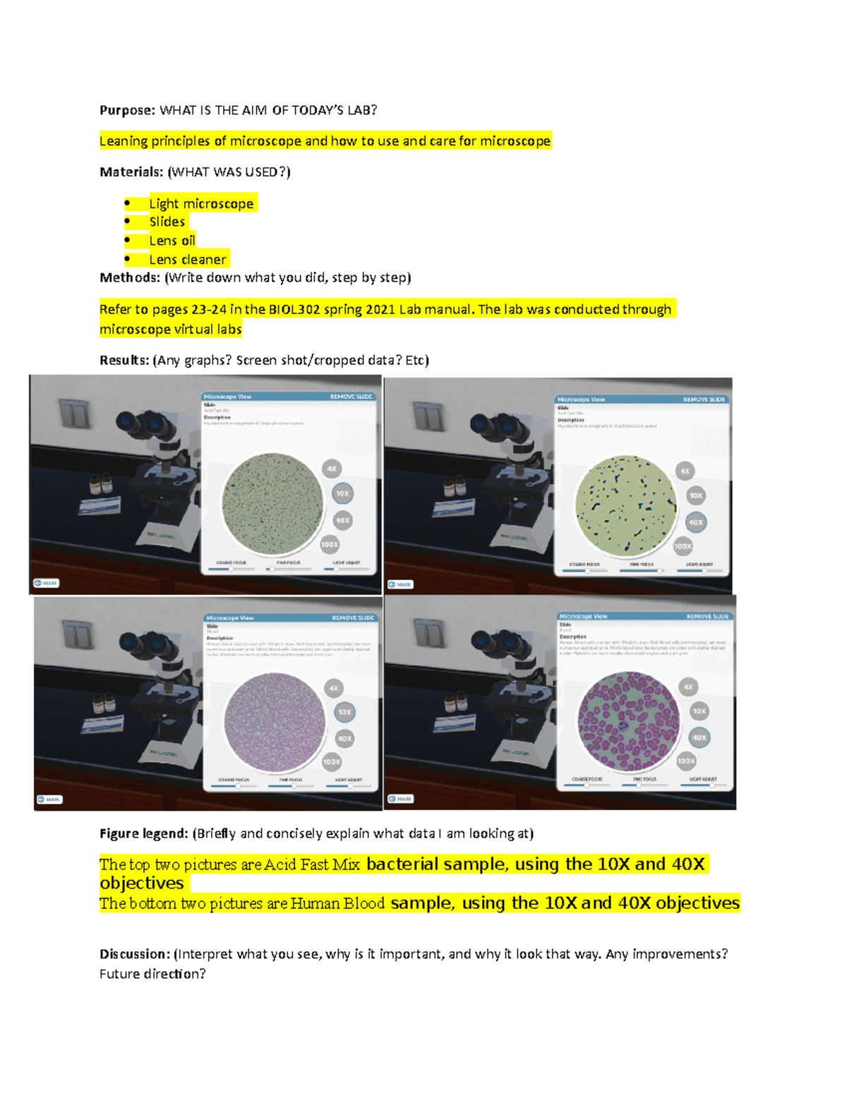 Microscope Purpose WHAT IS THE AIM OF TODAY’S LAB? Leaning