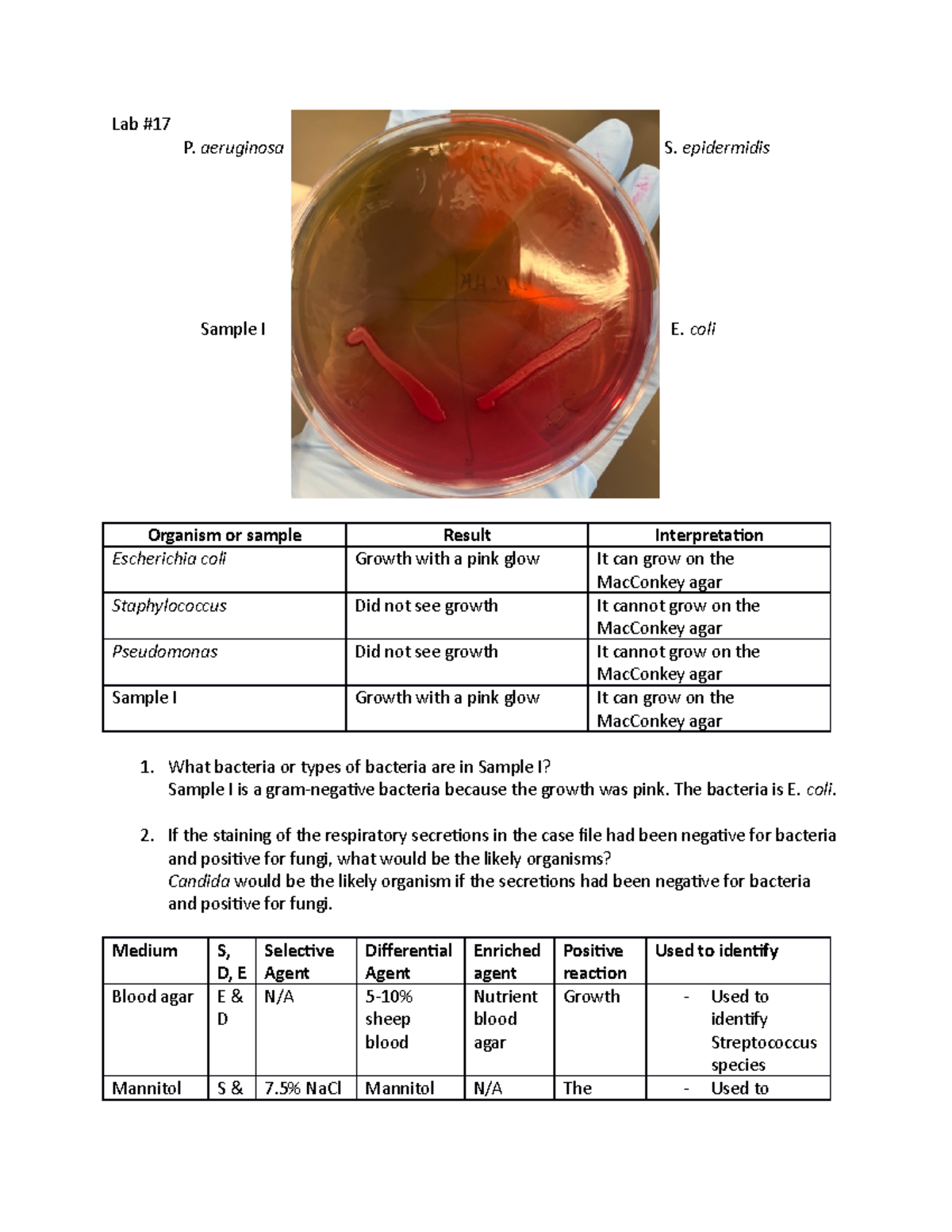 Lab #17 - Lab Report - Lab # P. aeruginosa S. epidermidis Sample I E ...