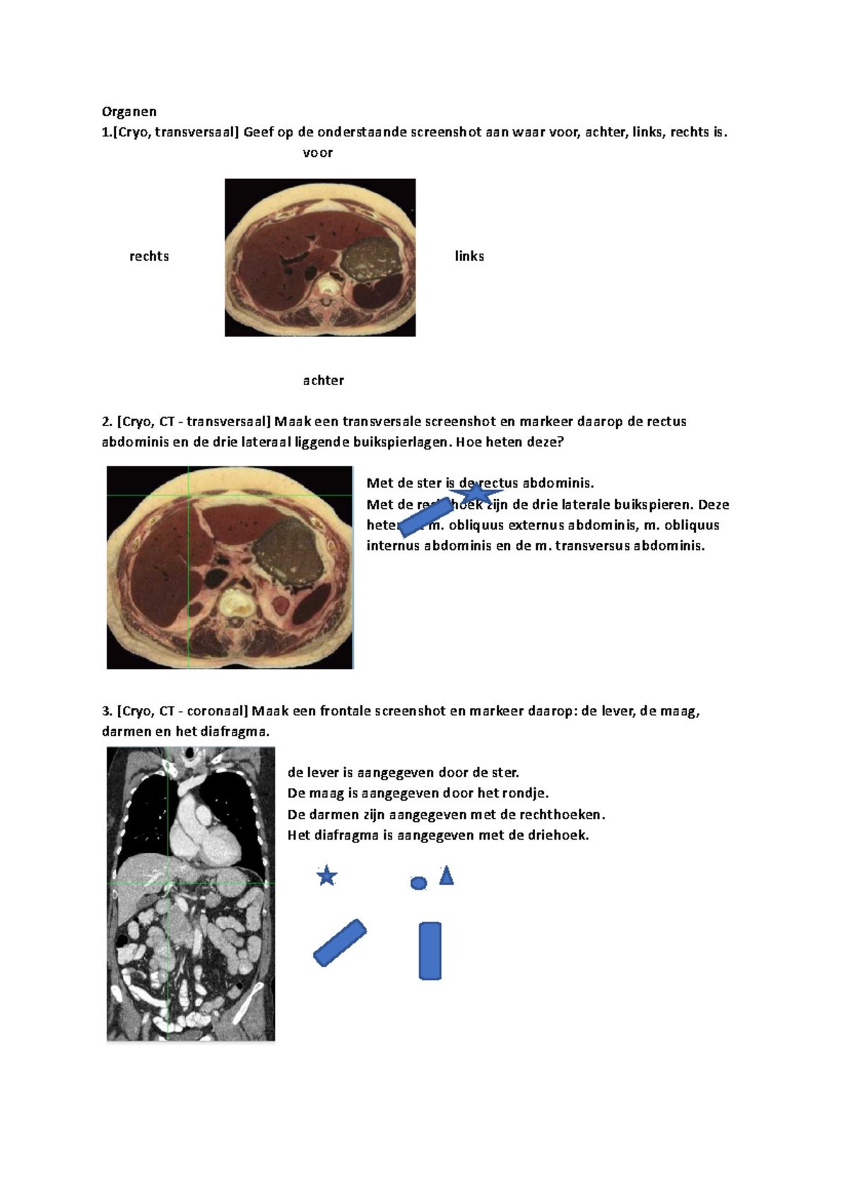 Macroscopie opdracht dwarsdoorsnede abdominen - Organen 1.[Cryo ...