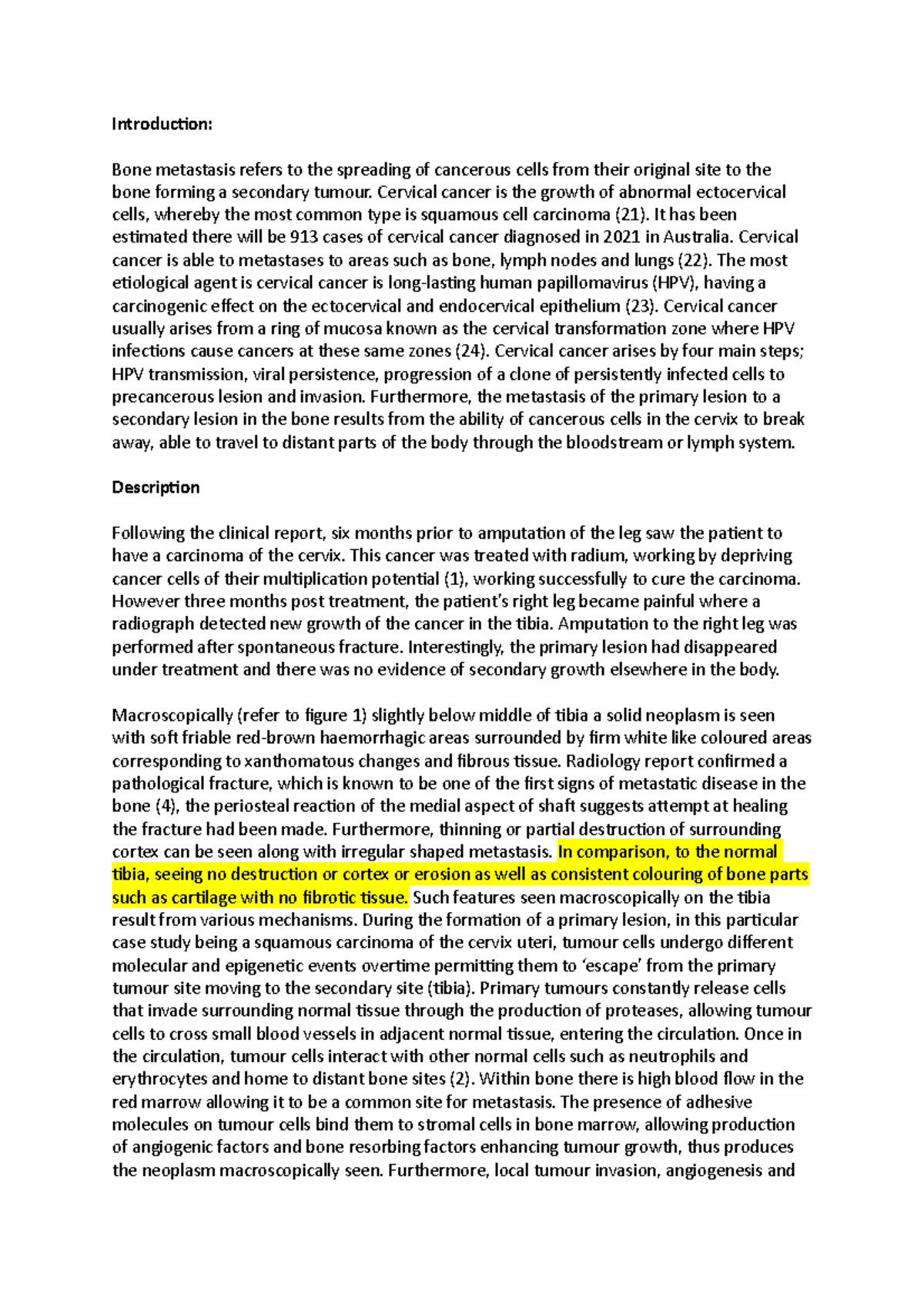 Bone essay - Bone metastasis from a cervical carcinoma, specimen was 76 ...