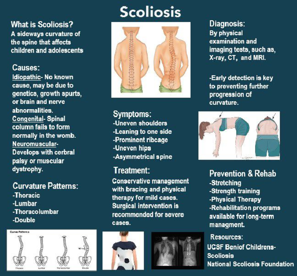 Scoliosis Flyer - N540B - Studocu