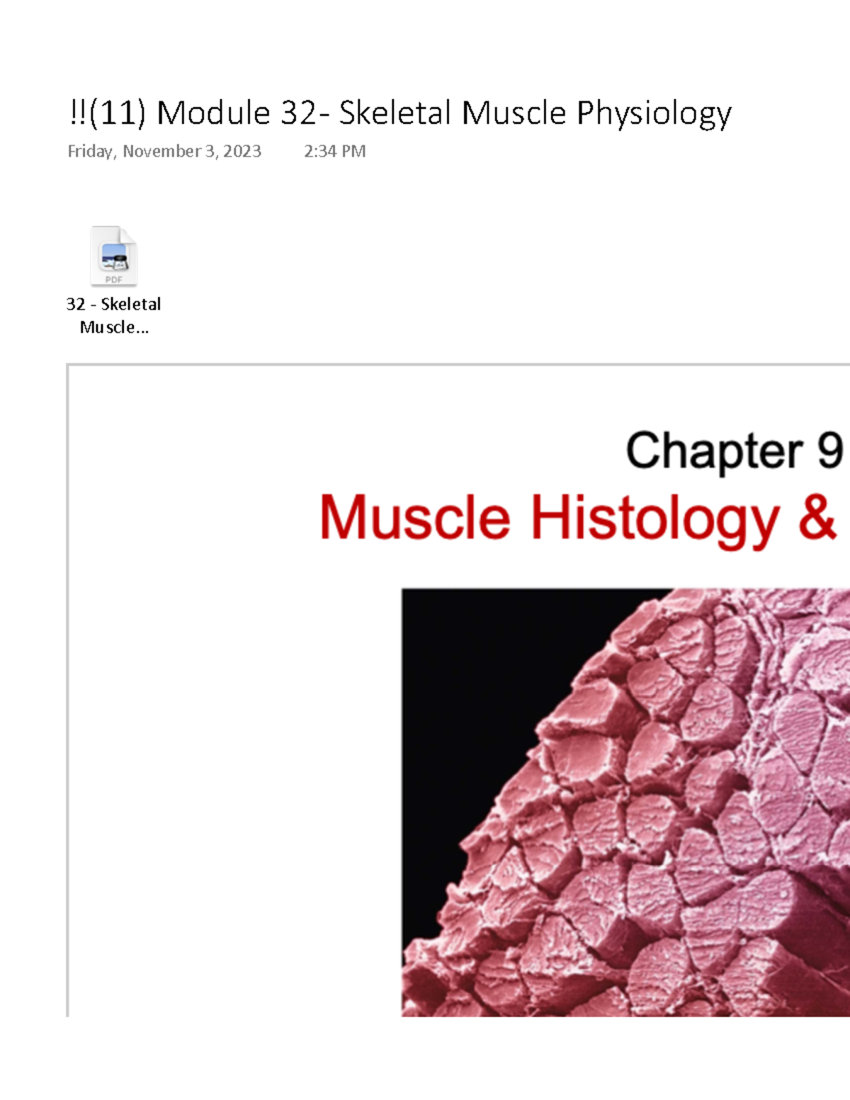 Module 32 - Skeletal Muscle Physiology - 32 - Skeletal Muscle... !!(11 ...