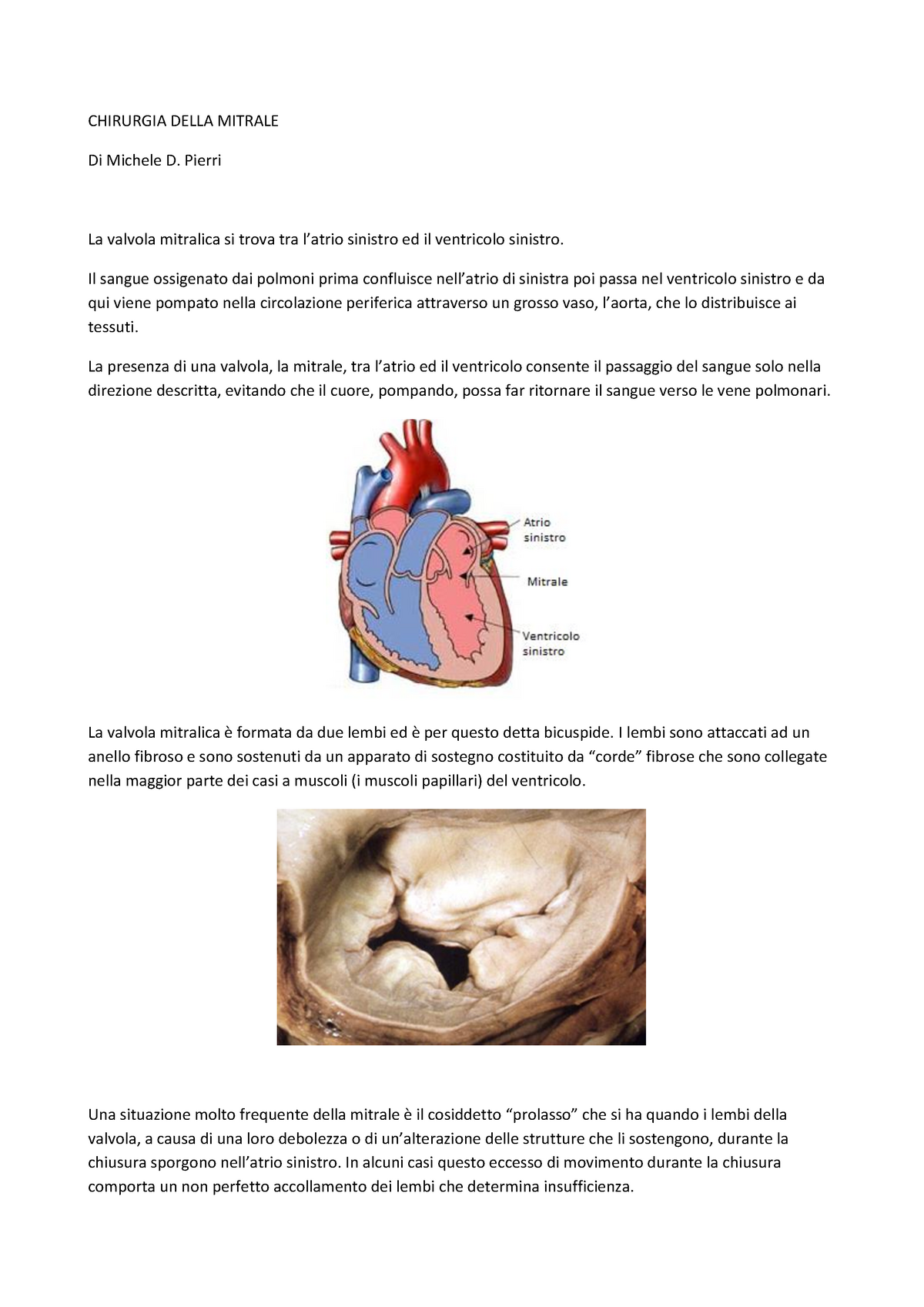 cuore ad anello fibroso