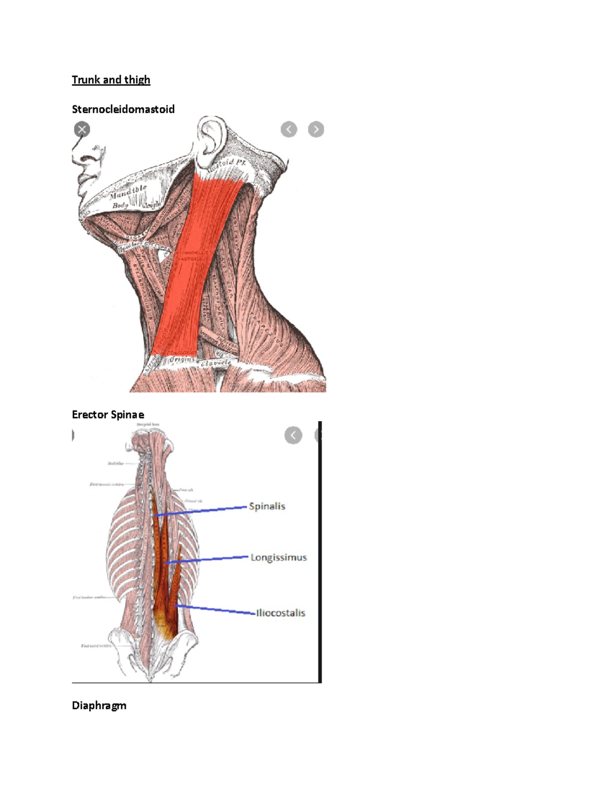 Anatomy Lab Test 2 Notes Trunk and thigh Sternocleidomastoid Erector