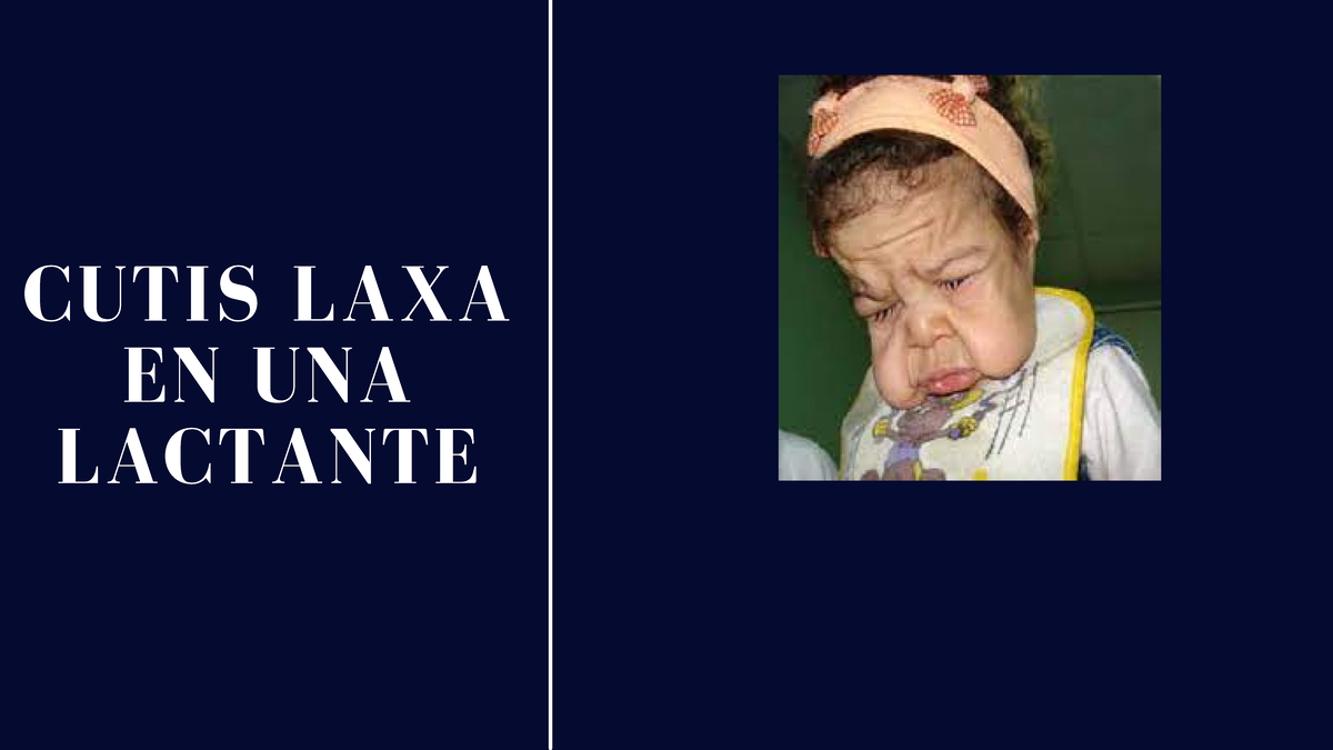 Abolir la cultura del ajetreo - CUTIS LAXA EN UNA LACTANTE TIPOS ...
