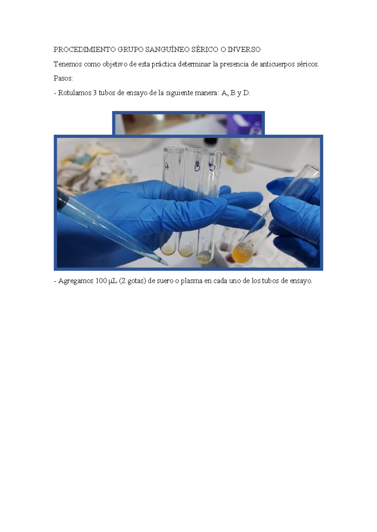 Procedimiento Grupo Sanguíneo Sérico O Inverso - Bioquímica ...