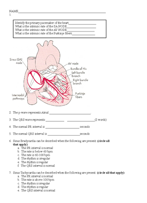 Pedi- concept map Myelomeningocele - → Planning: Concept/Disease/Patho ...