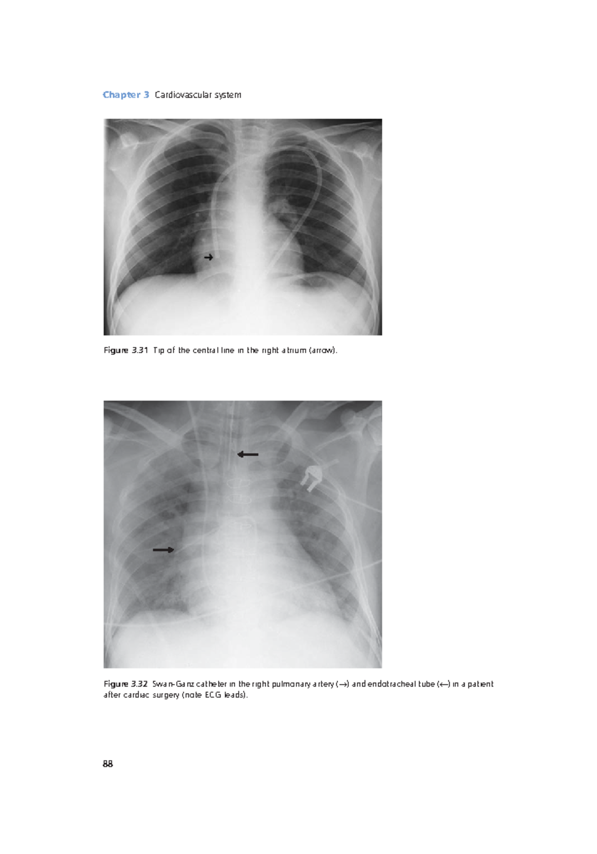 Radiology Lecture Notes Pdf (30) - Chapter 3 Cardiovascular System 88 