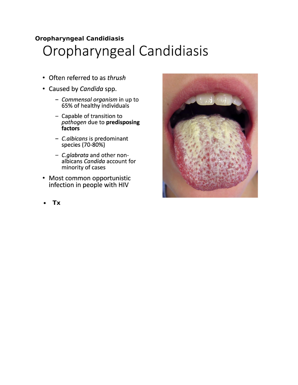 ID Exam 4 Oropharyngeal Candidiasis - EPID 0552 - Oropharyngeal ...