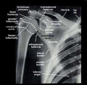 Radiographs Upper Limb - supraglenoid tubercle acromium head humeruss ...