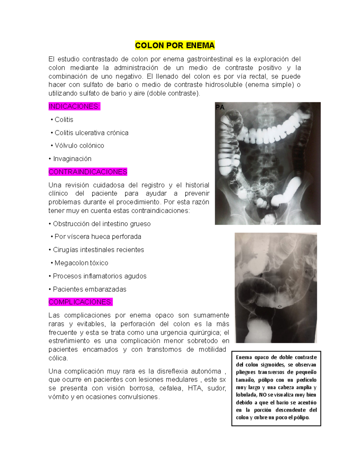 Colon por enema, cáncer colón, diverticulitis Enema opaco de doble
