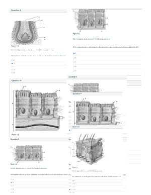 Anatomy Week 8 Discussion Stroke - Week 8 Anatomy Discussion: STROKE ...