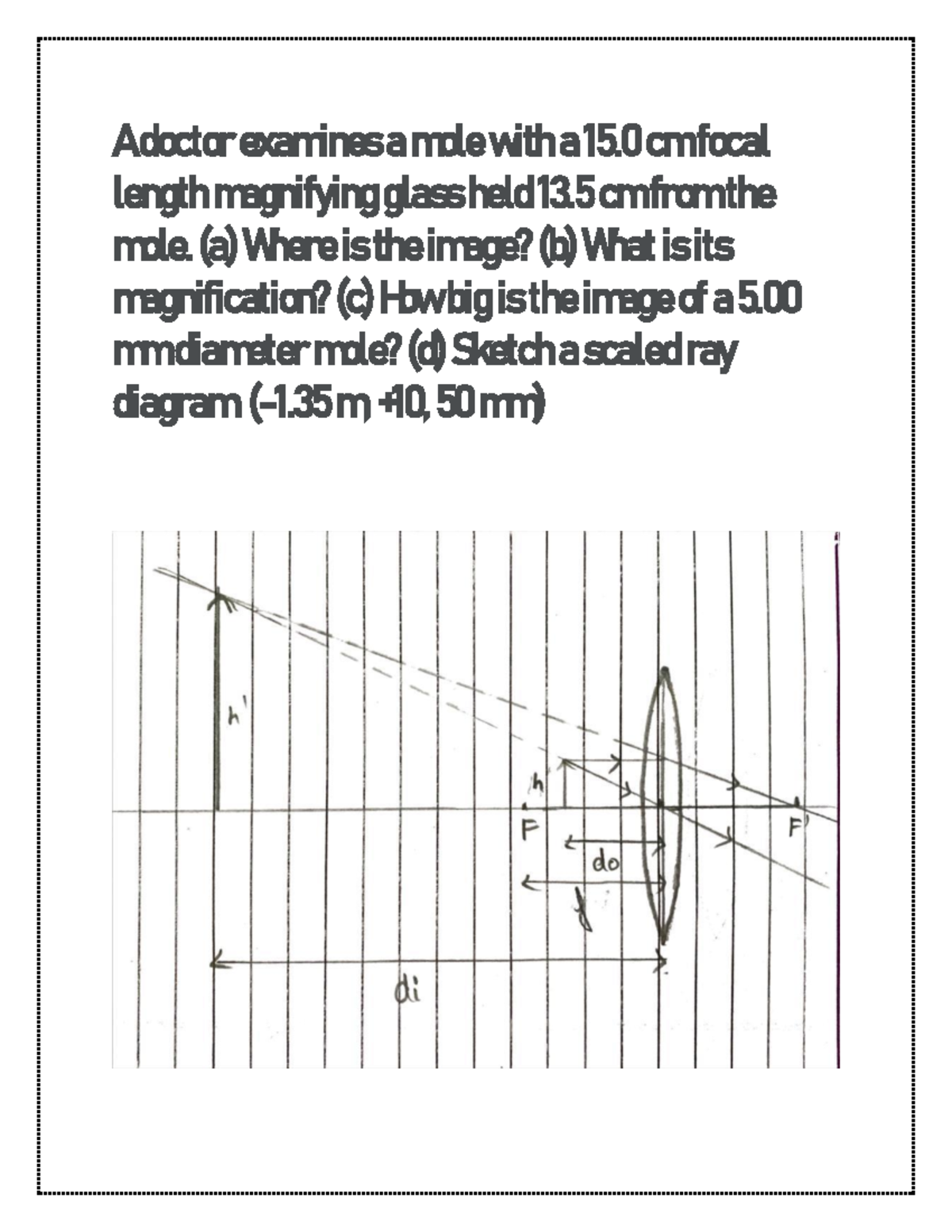 Phys sub 12 Phys sub 12 A doctor examines a mole with a 15. 0 cm