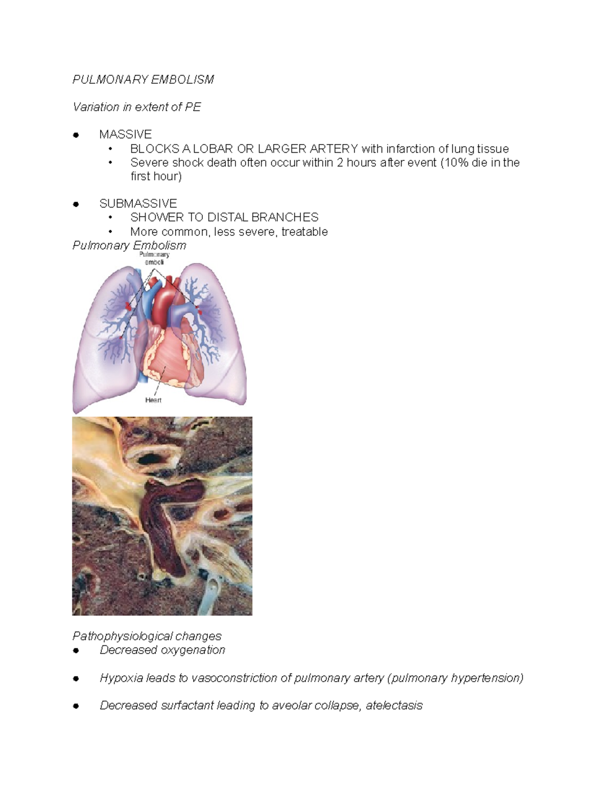 Pulmonary Embolism - PULMONARY EMBOLISM Variation in extent of PE ...