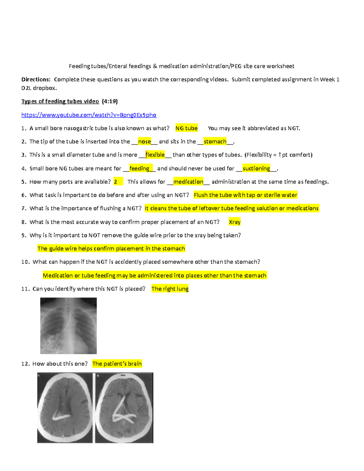 Feeding Tubes Worksheet With Answers - Feeding Tubes/Enteral Feedings ...