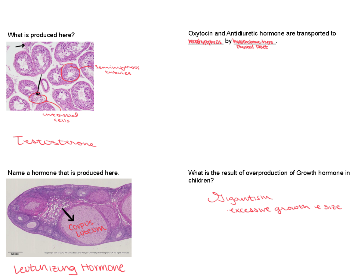 LAB Midterm Review - What is produced here? Oxytocin and Antidiuretic ...