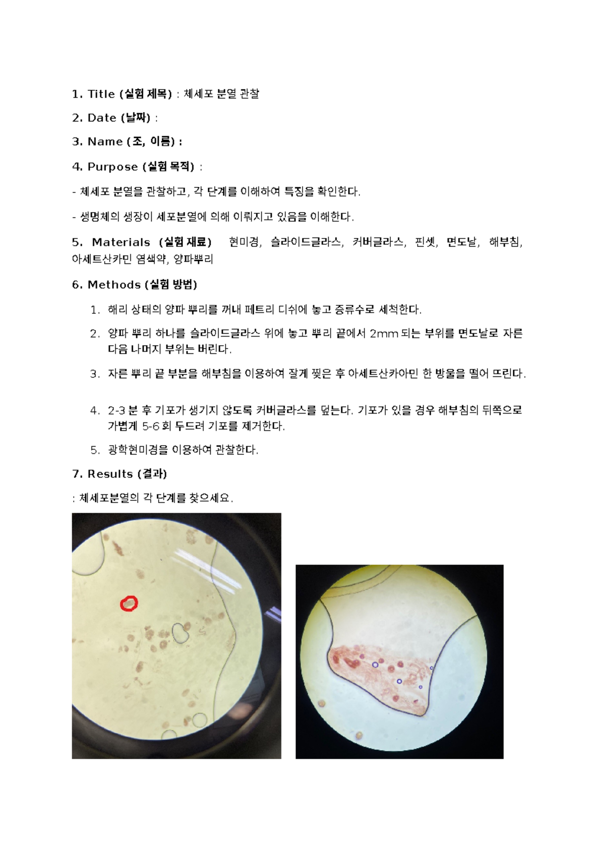 6주차 체세포분열관찰 레포트 - Title (실험 제목) : 체세포 분열 관찰 Date (날짜) : Name (조, 이름 ...