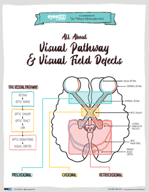 Visual Pathway Lesions + Visual Field Defects - IN COLLABORATION WITH ...