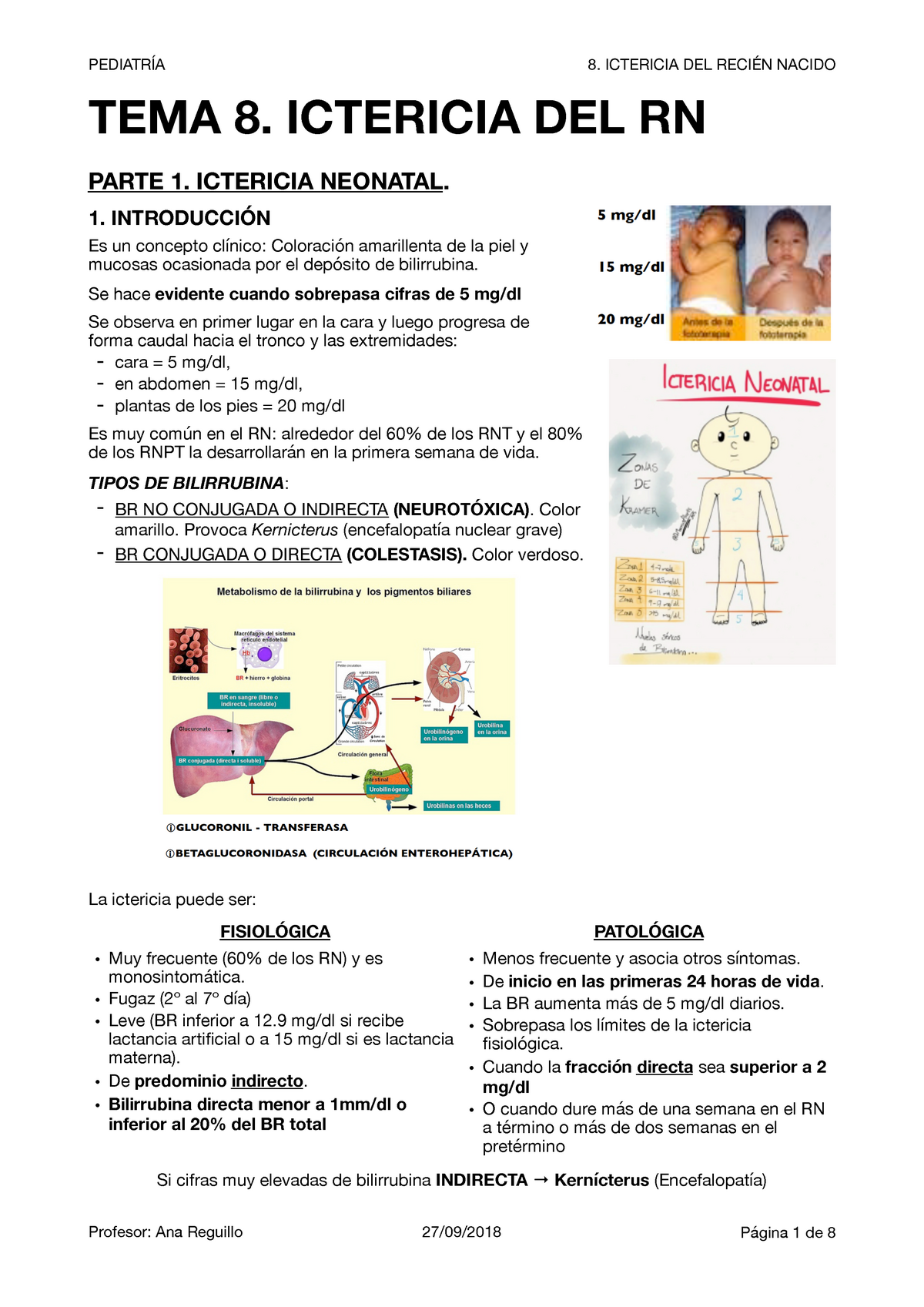 8. Ictericia Del Recién Nacido - PEDIATRÍA 8. ICTERICIA DEL RECIÉN ...