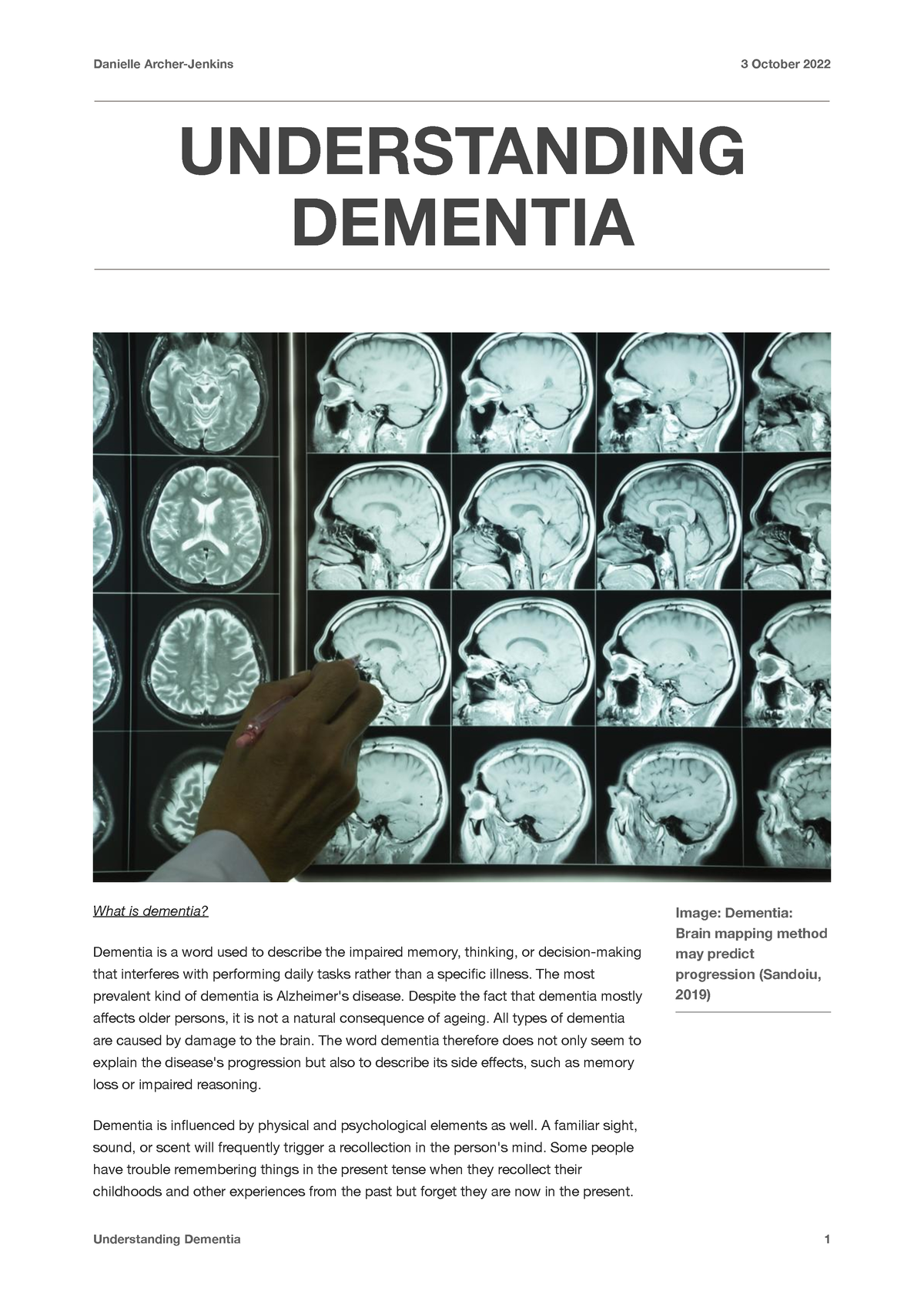 understanding dementia assignment