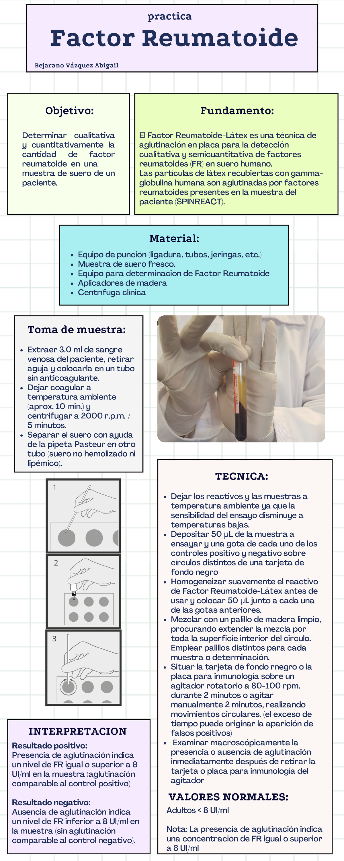 Factor reumatoide - Factor Reumatoide practica Bejarano Vázquez Abigail ...