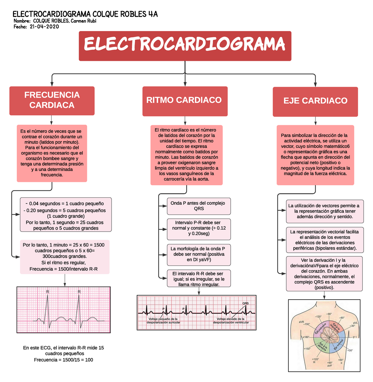 Electrocardiograma - ELECTROCARDIOGRAMA COLQUE ROBLES 4A Nombre: COLQUE  ROBLES, Carmen Rubí Fecha: - Studocu