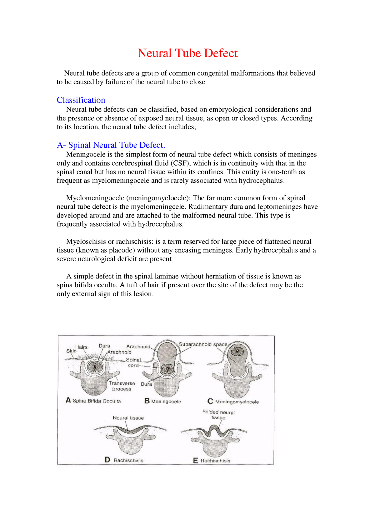 Neural Tube Defect Neural Tube Defect Neural tube defects are a group