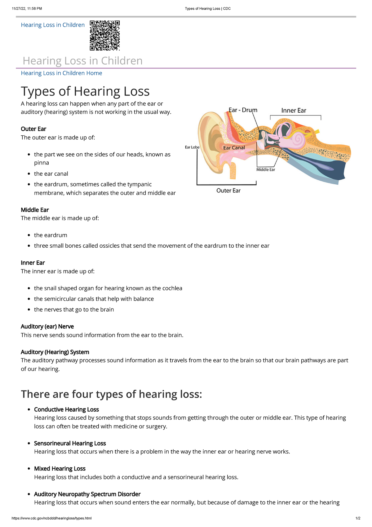 Types of Hearing Loss CDC html 1/ Hearing Loss in Children Hearing