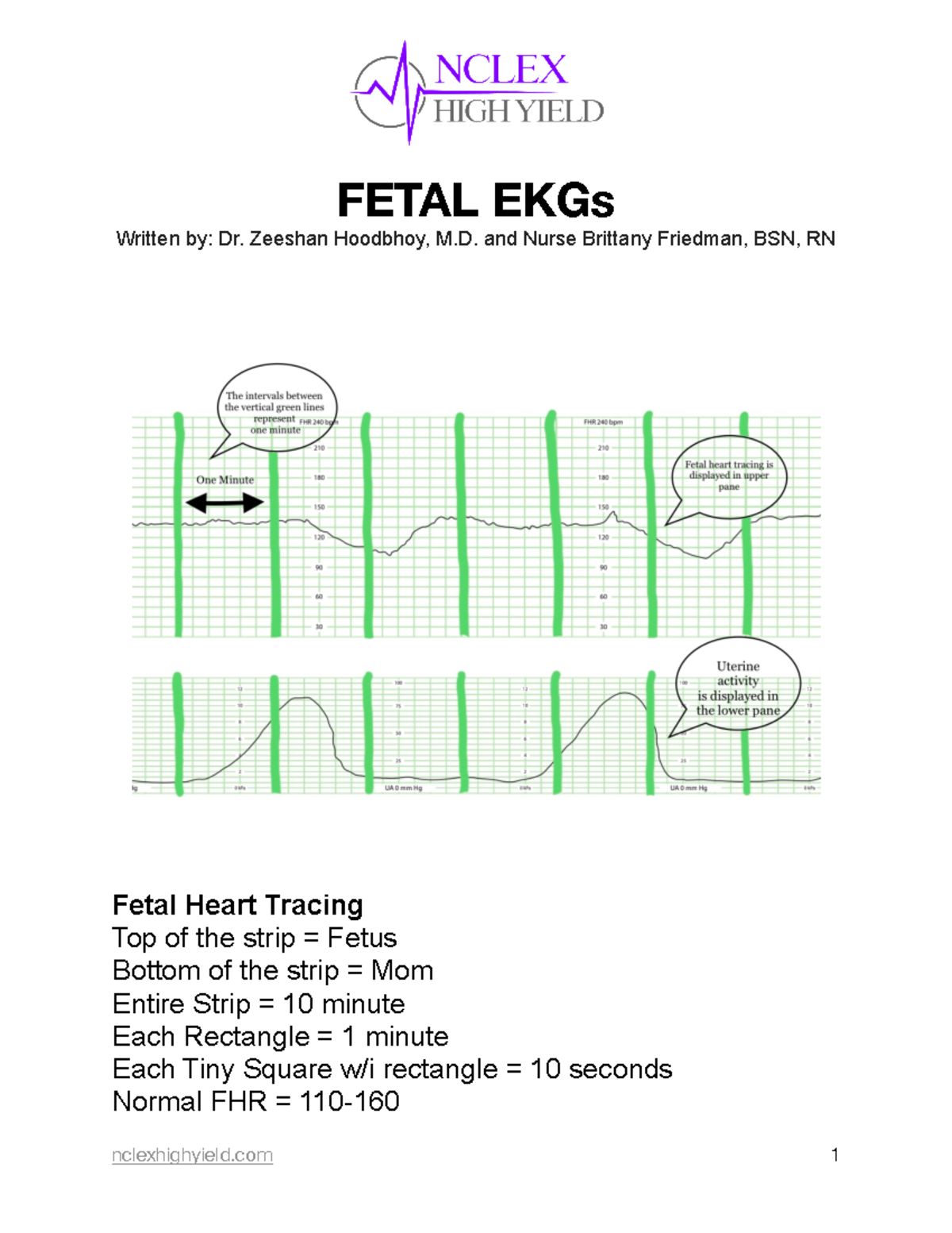 Fetal EKGs - FETAL EKGs Written by: Dr. Zeeshan Hoodbhoy, M. and Nurse ...