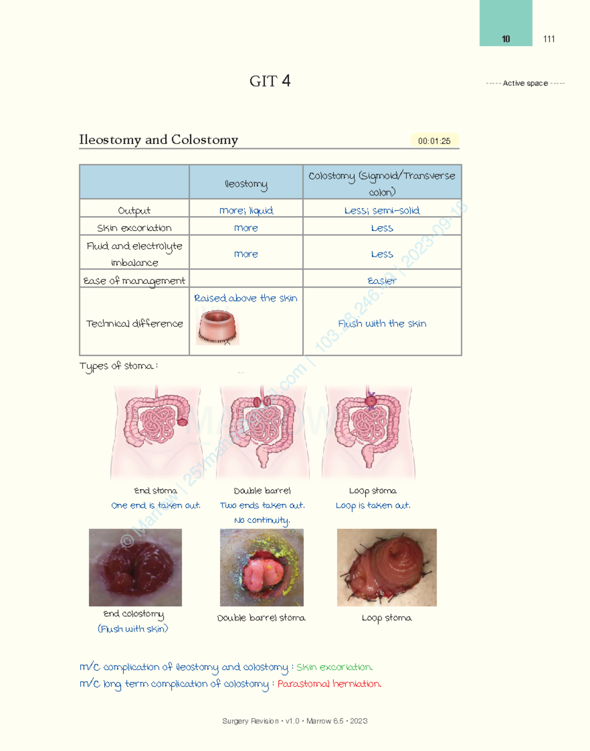 Intestinal Fistula After Ileostomy Revision