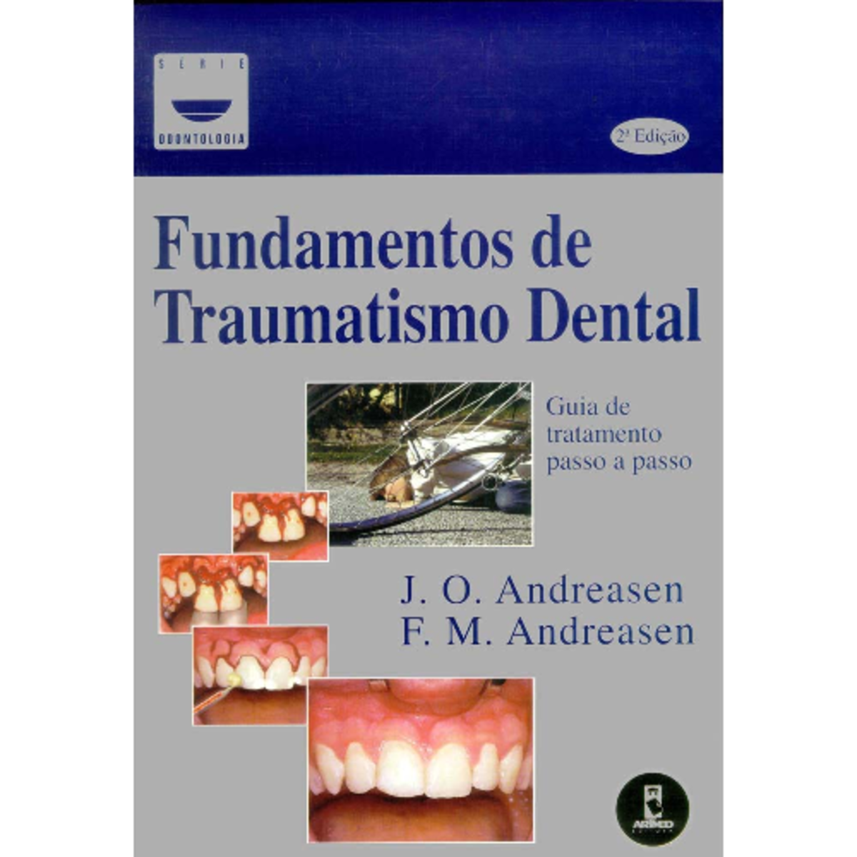 2. Fundamentos de Traumatismo dental 2ª Ed. 1990 - Andreasen - Cirurgia ...