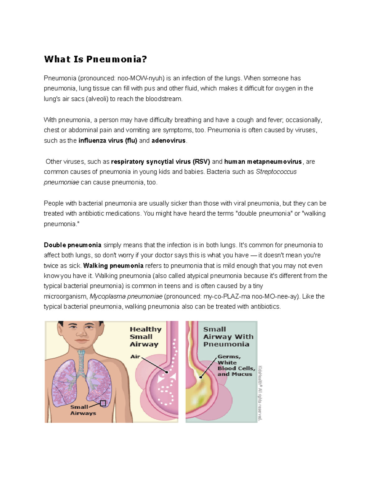 What Is Pneumonia - Virtual Clinical Reading - What Is Pneumonia ...