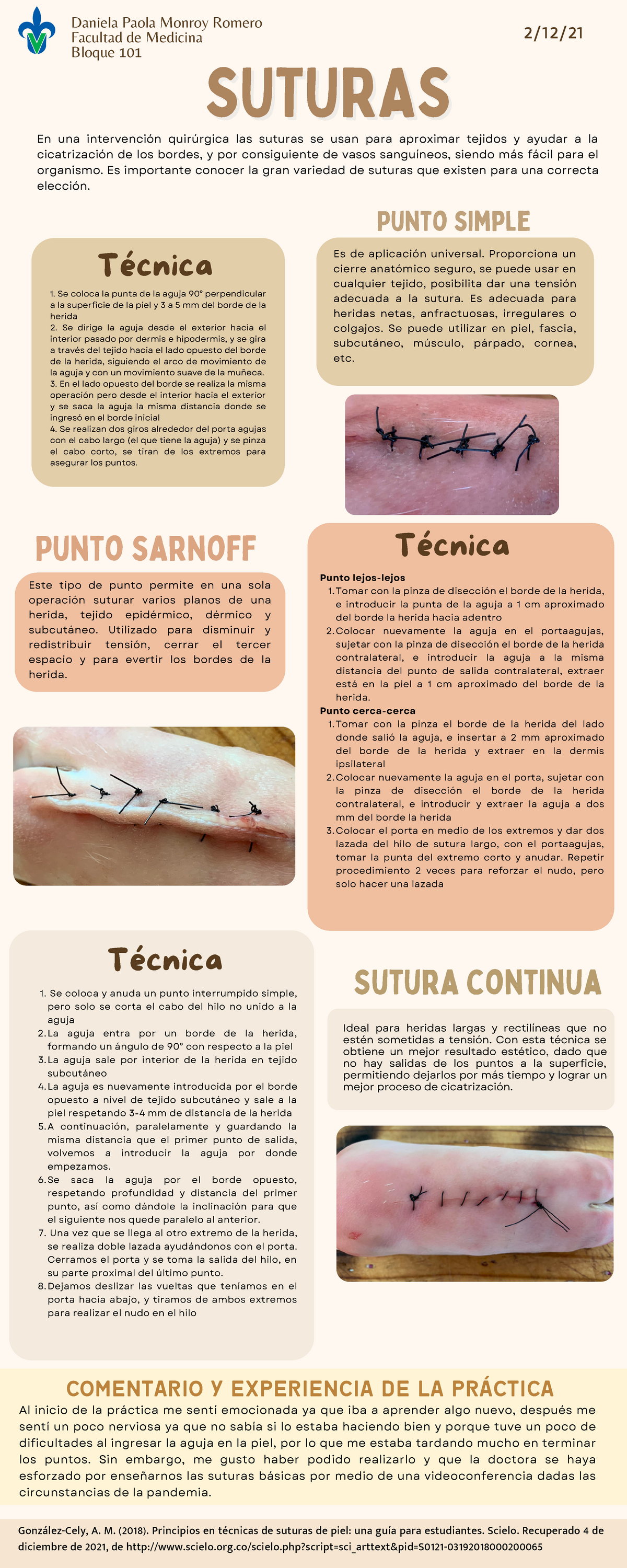 medico_clasico - TIPOS DE SUTURAS Las suturas es cualquier tipo de material  utilizado para ayudar a la cicatrización de una herida, mediante la  aproximación de los bordes con el objetivo de mantenerlos