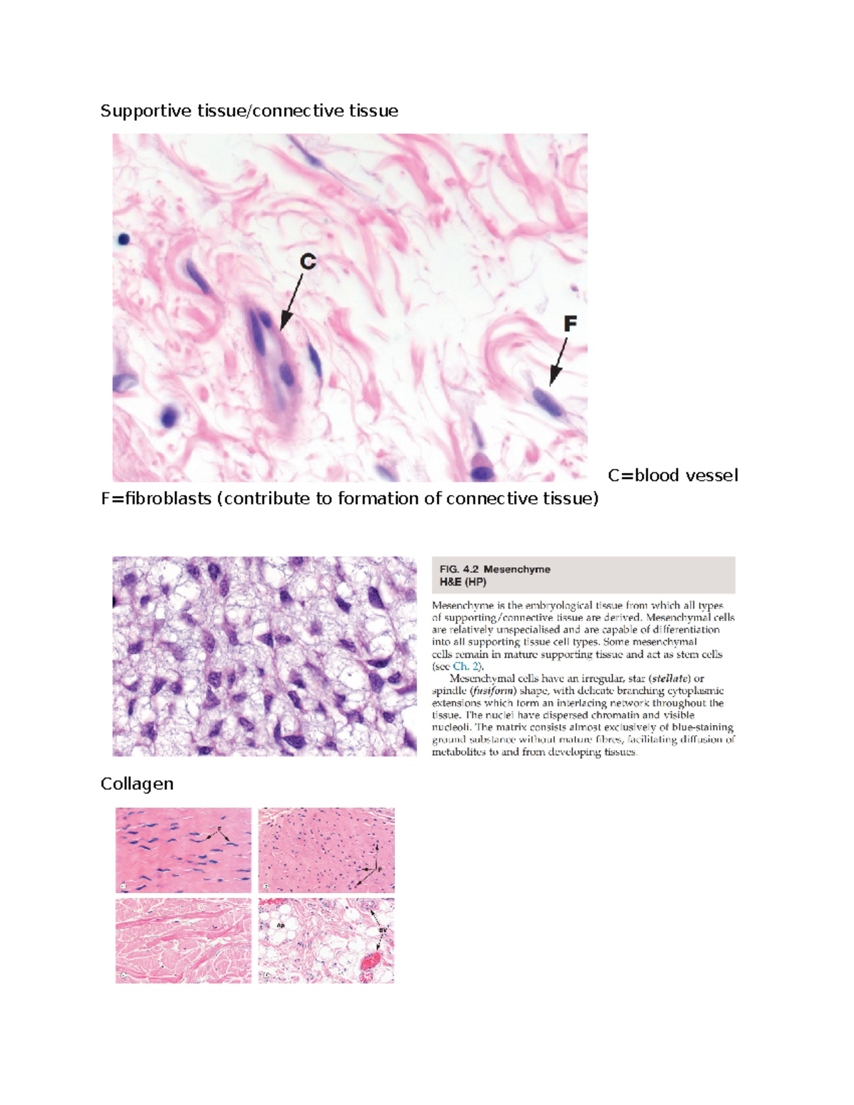 tissue biology exam - Supportive tissue/connective tissue C=blood ...