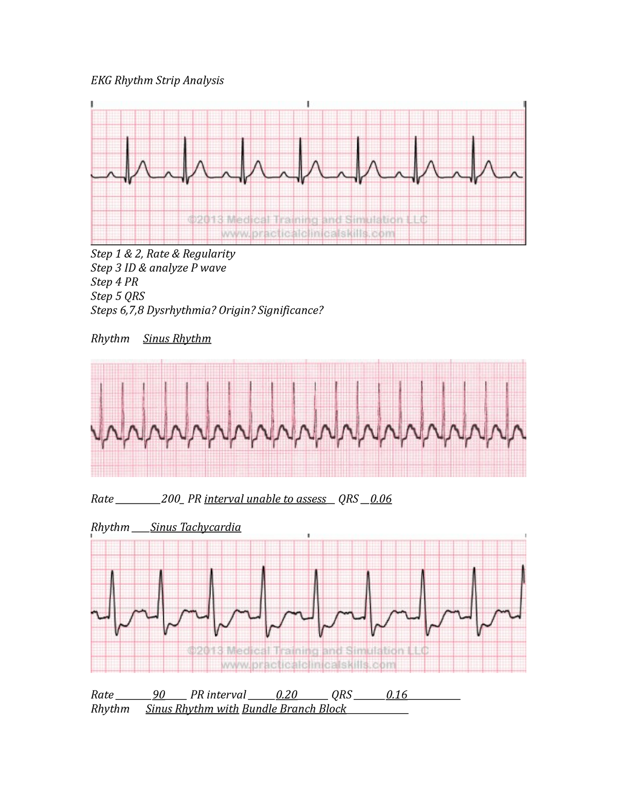 EKG Rhythm Strip Analysis w answers - EKG Rhythm Strip Analysis Step 1 ...