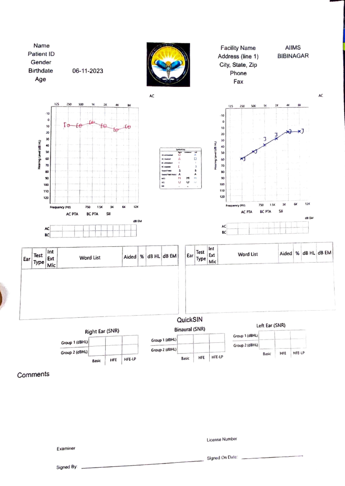 Audiometry charts - Ear Name Patient ID Gender Btrthdate Age 06-11- llS ...