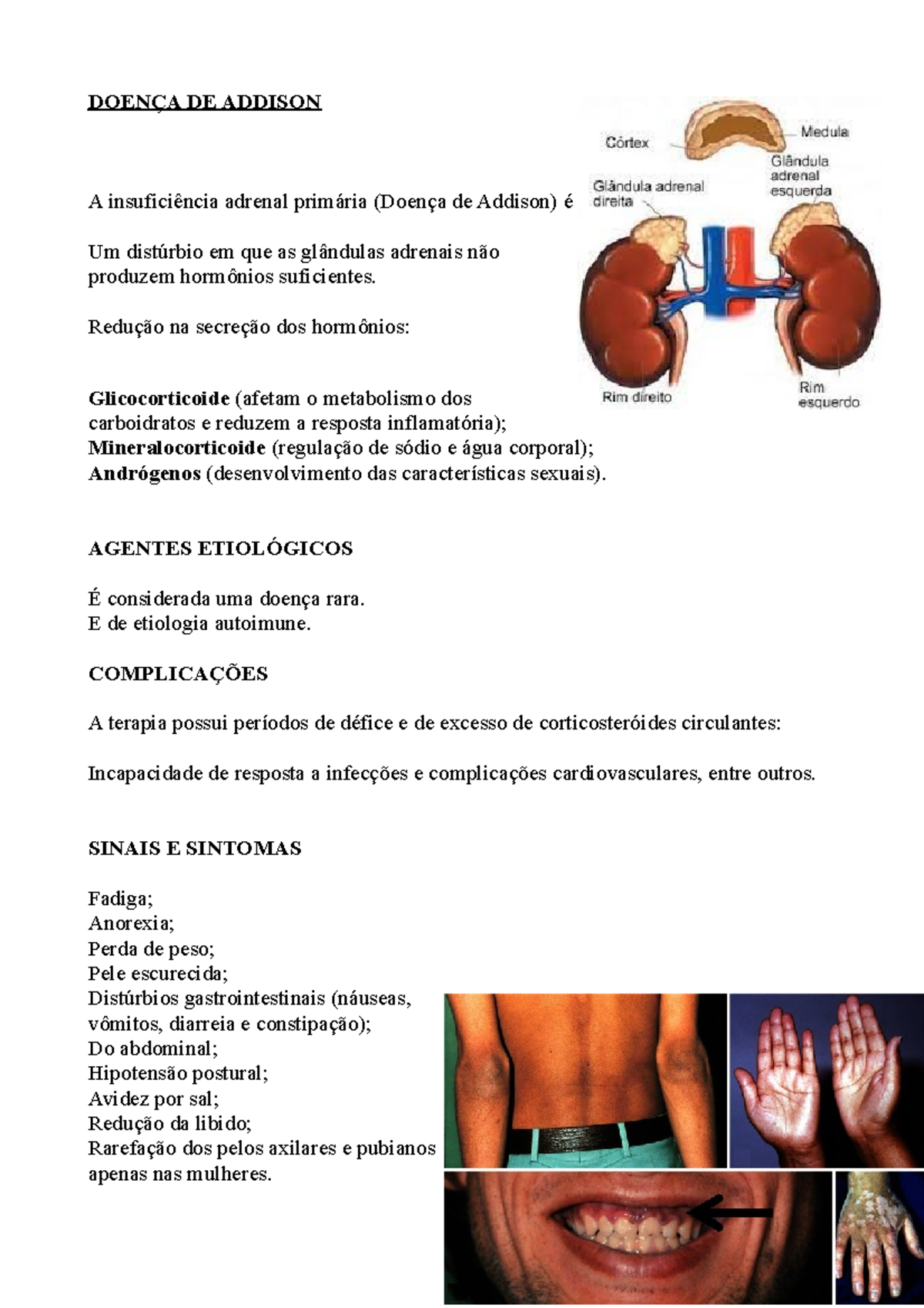 Doenças endronicas: Sindrome de cushing e doença de addison - DOENÇA DE ...
