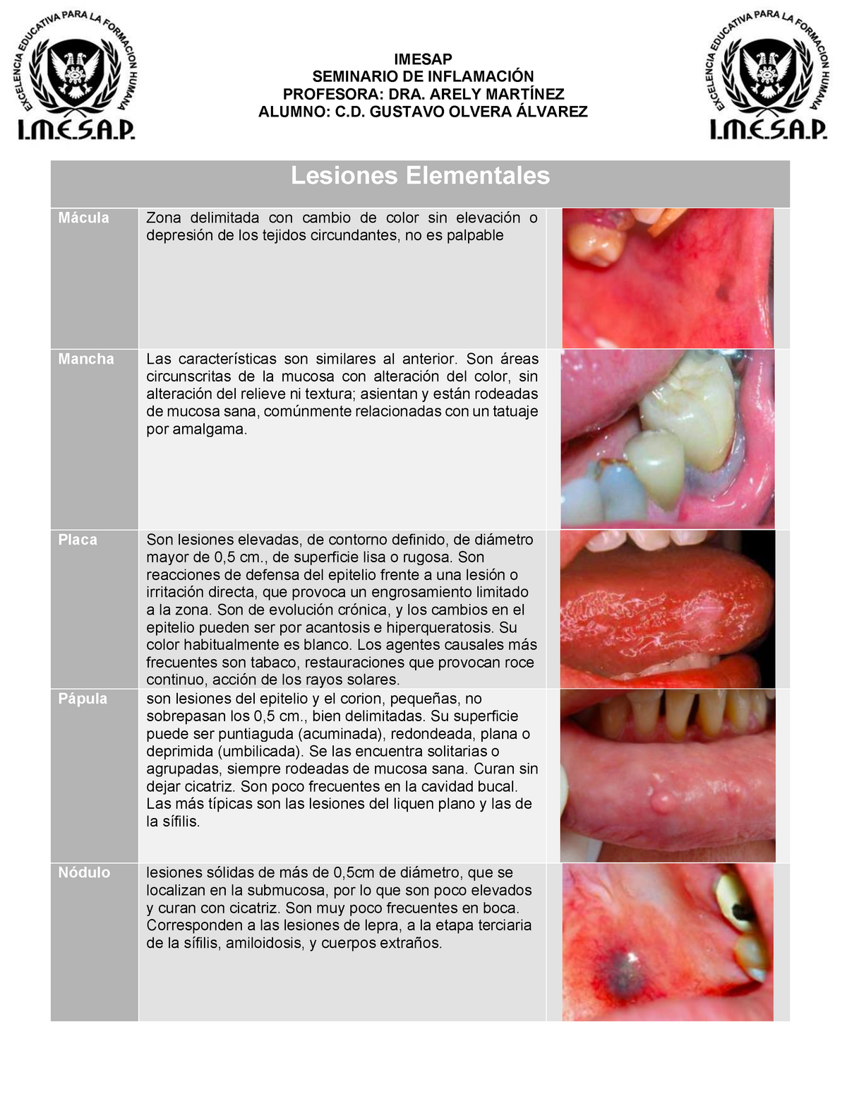 Lesiones Elementales - Patología Bucal - UNAM - Studocu