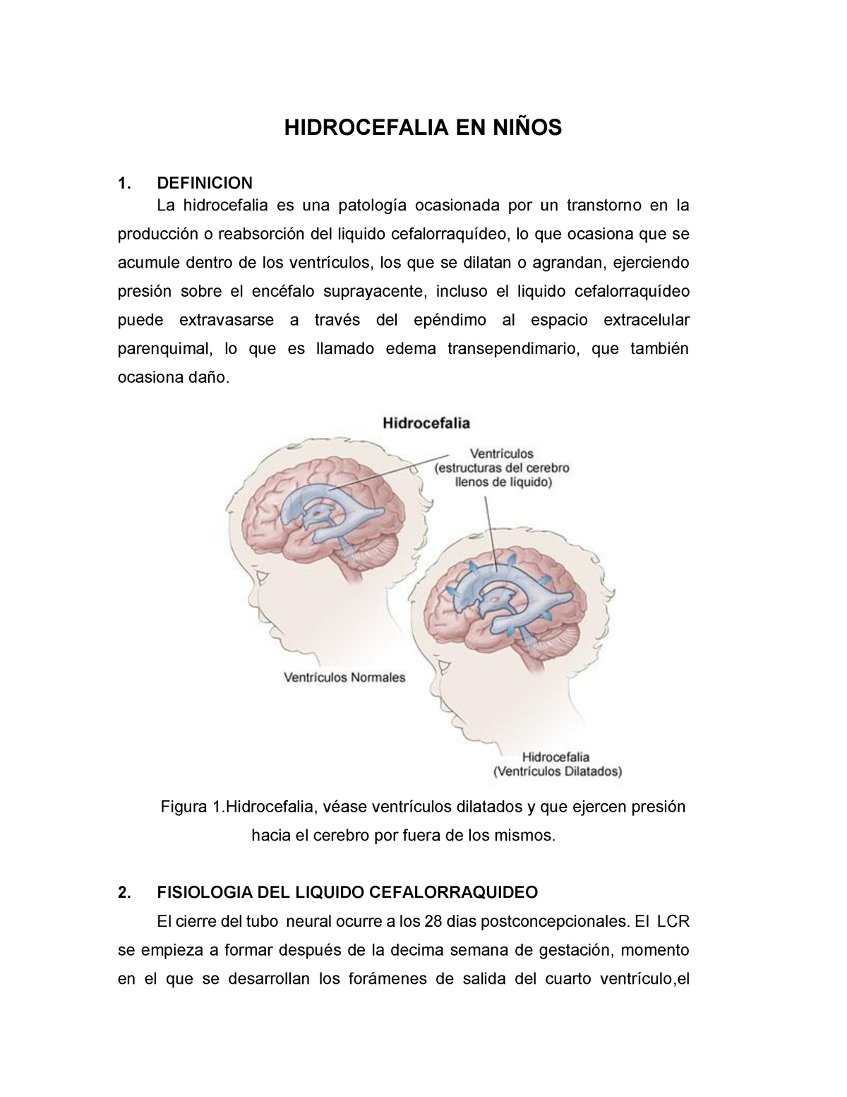 Hidrocefalia Hidrocefalia En NiÑos 1 Definicion La Hidrocefalia Es Una Patología Ocasionada 1582