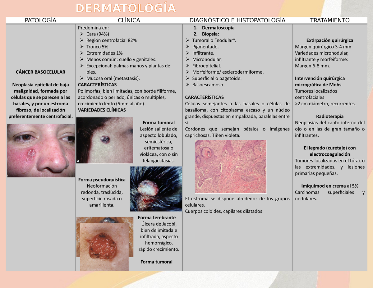 Derma Cáncer basocelular carcinoma epidermoide y melanoma PATOLOGÍA CLÍNICA DIAGNÓSTICO E
