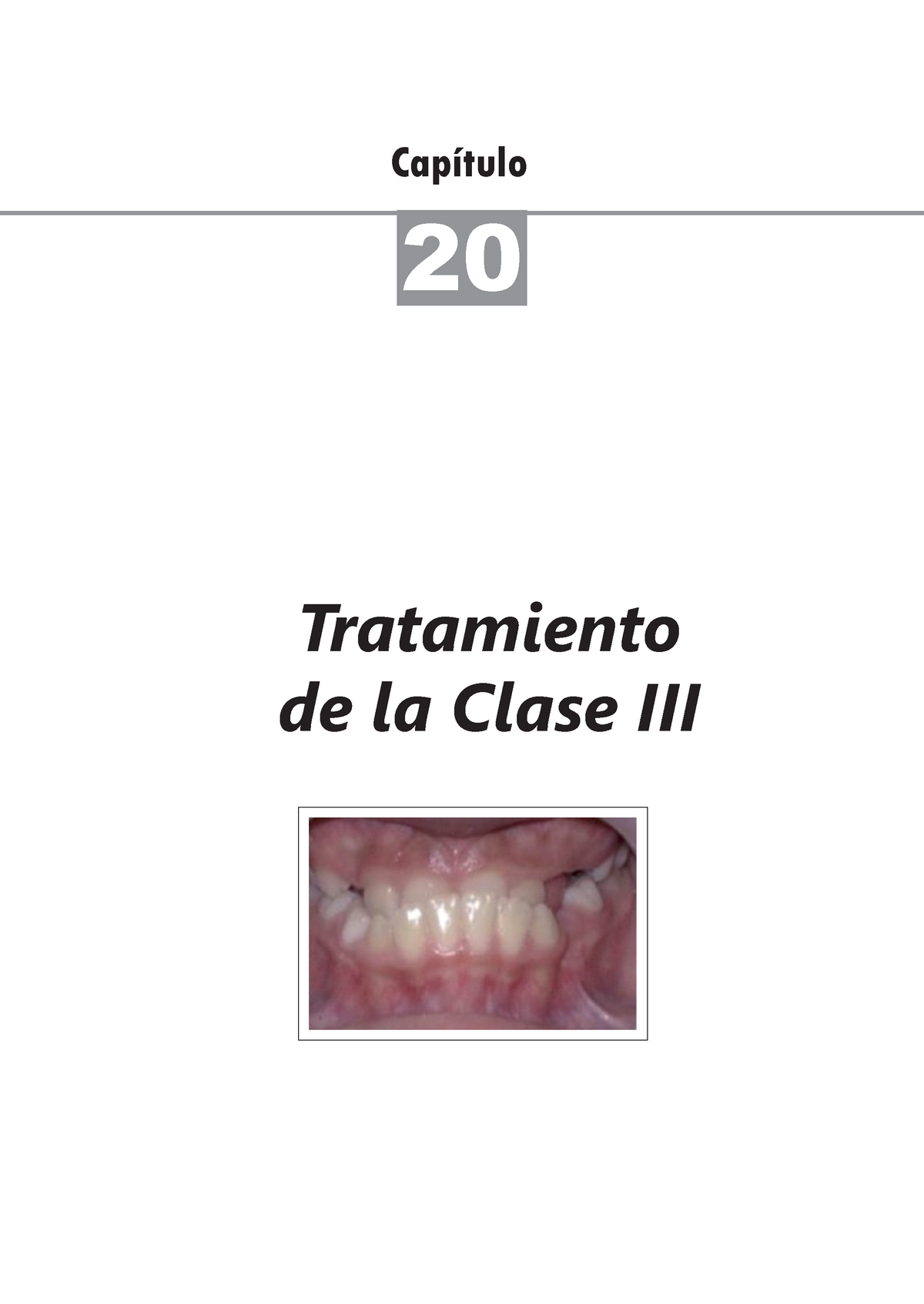 Tratamiento Clase Iii Articulo Cap Tulo Tratamiento De La Clase Iii Tratamiento De La