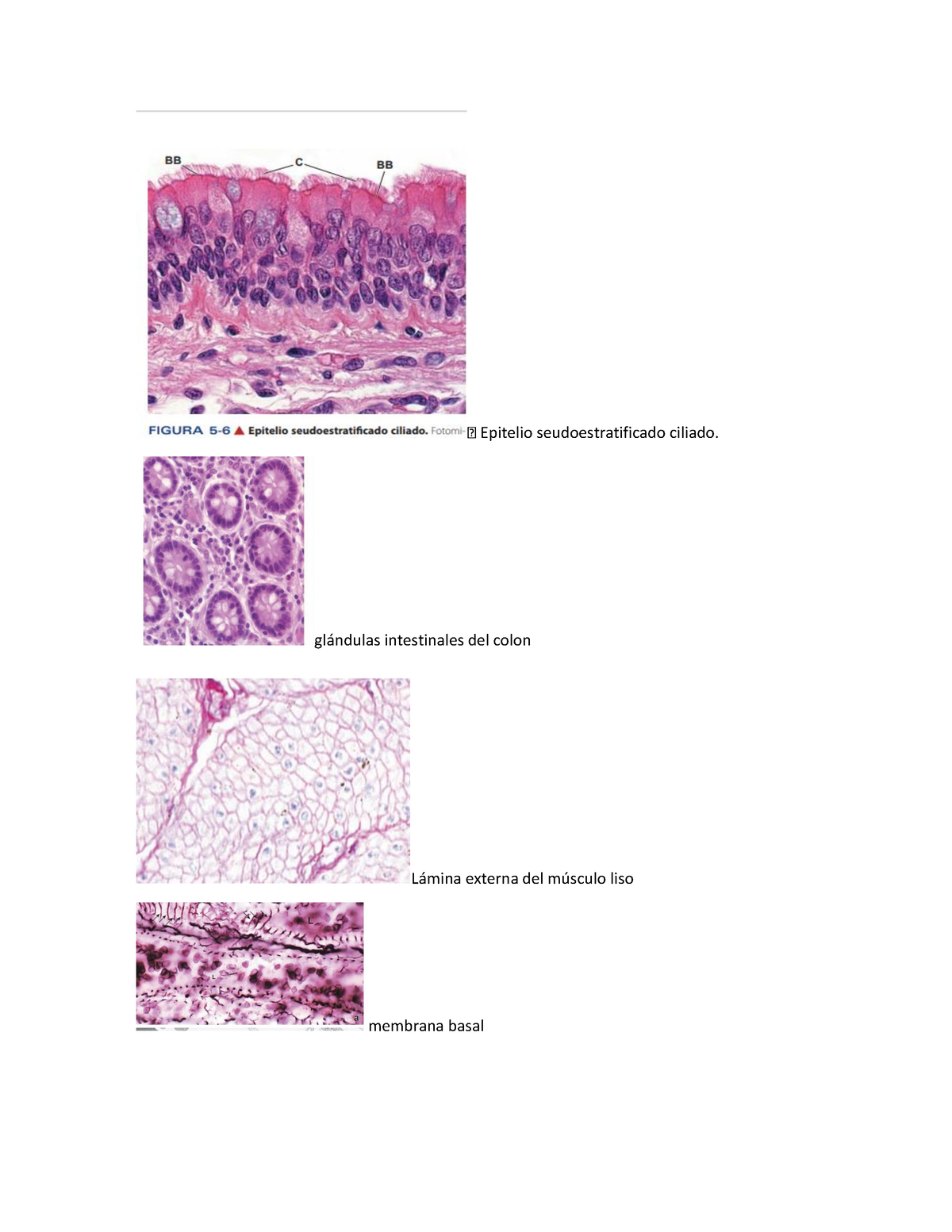 Cortes Histologicos - Epitelio Seudoestratificado Ciliado. Gl·ndulas ...