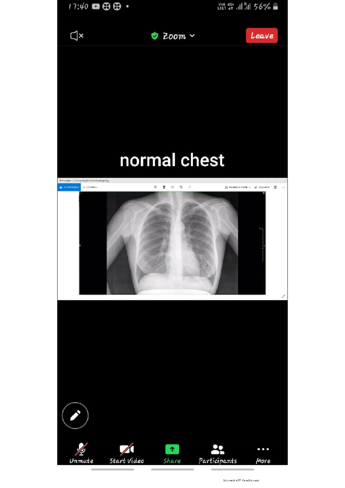 Radiology chest X ray part1 Surgery and medicine bachelors Studocu