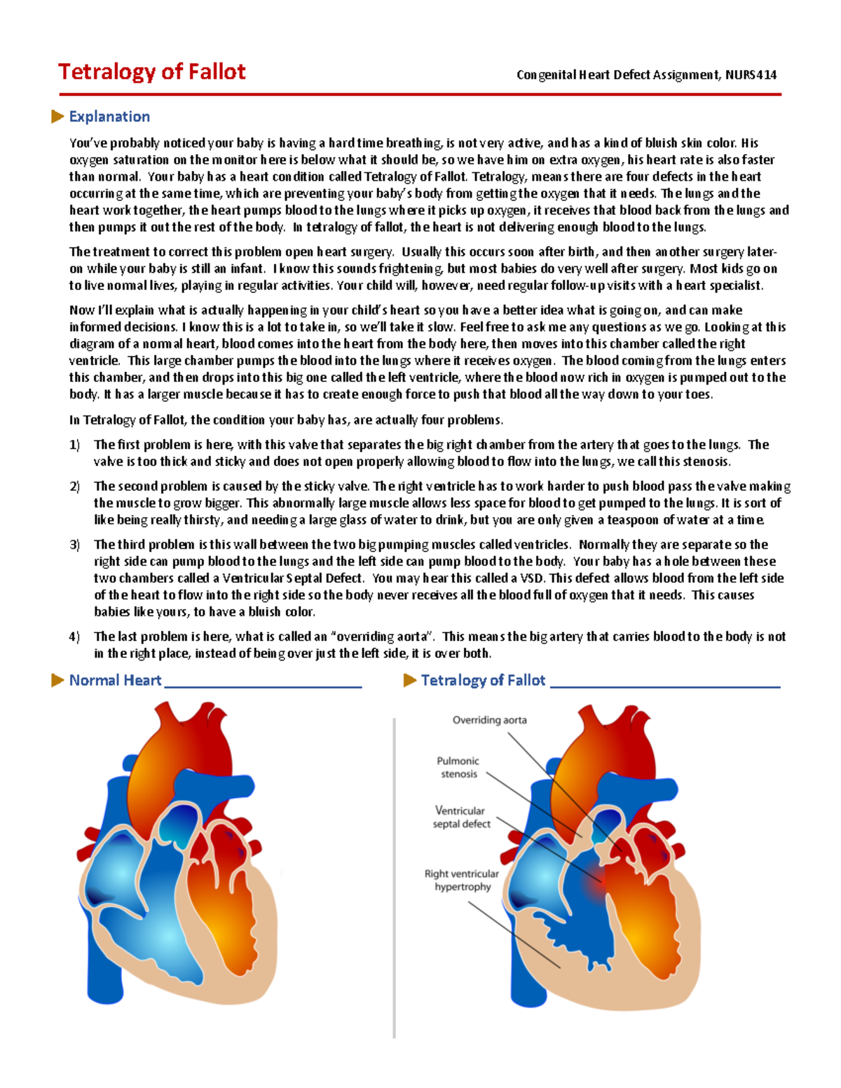 N414 Tetralogy of Fallot - Tetralogy of Fallot u Explanation You’ve ...